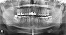 %_tempFileNameImplant%2048i1%