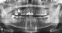%_tempFileNameImplant%2048i2%