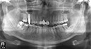 %_tempFileNameImplant%2048i3%