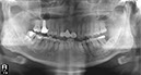 %_tempFileNameImplant%2048i4%