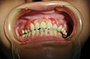%_tempFileNameImplant%2053a1%