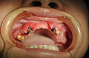%_tempFileNameImplant%2053a2%