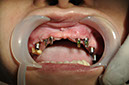 %_tempFileNameImplant%2053d1%