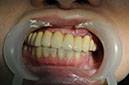 %_tempFileNameImplant%2053e1%
