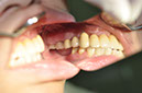 %_tempFileNameImplant%2053e3%