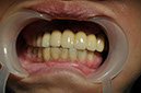 %_tempFileNameImplant%2053f1%