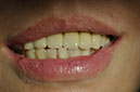%_tempFileNameImplant%2053f2%