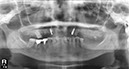 %_tempFileNameImplant%2053g1%