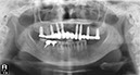 %_tempFileNameImplant%2053g2%