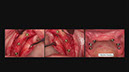 %_tempFileNameImplant%2053h4%