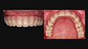 %_tempFileNameImplant%2053h5%