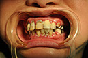 %_tempFileNameImplant%2055a1%