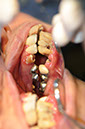 %_tempFileNameImplant%2055a2%