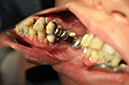 %_tempFileNameImplant%2055a3%