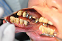 %_tempFileNameImplant%2055a4%