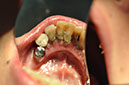 %_tempFileNameImplant%2055a5%