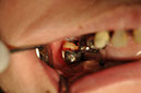 %_tempFileNameImplant%2055b1%