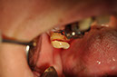 %_tempFileNameImplant%2055b2%