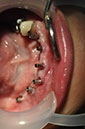%_tempFileNameImplant%2055b3%