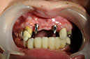 %_tempFileNameImplant%2055b4%