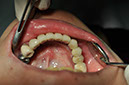 %_tempFileNameImplant%2055c1%