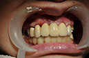 %_tempFileNameImplant%2055d1%