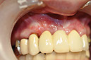 %_tempFileNameImplant%2055d2%