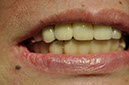 %_tempFileNameImplant%2055d3%