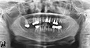 %_tempFileNameImplant%2055e1%