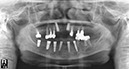 %_tempFileNameImplant%2055e2%