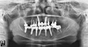 %_tempFileNameImplant%2055e3%