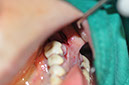 %_tempFileNameImplant%2058b1%
