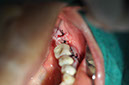 %_tempFileNameImplant%2058b3%