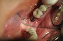 %_tempFileNameImplant%2058c2%