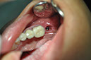 %_tempFileNameImplant%2058c4%