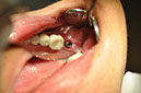 %_tempFileNameImplant%2058c5%