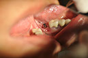 %_tempFileNameImplant%2058c6%