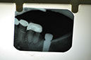 %_tempFileNameImplant%2058e1%