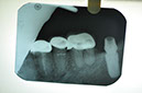 %_tempFileNameImplant%2058e2%