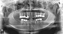 %_tempFileNameImplant%2058f1%