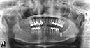 %_tempFileNameImplant%2058f2%