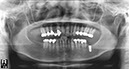 %_tempFileNameImplant%2058f3%