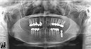 %_tempFileNameImplant%2058f4%