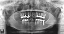 %_tempFileNameImplant%2058f5%