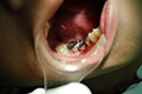 %_tempFileNameImplant%205a%