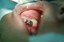 %_tempFileNameImplant%205b%