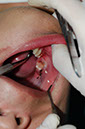 %_tempFileNameImplant%205e%