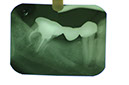 %_tempFileNameImplant%205q3%