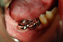 %_tempFileNameImplant%205t1%