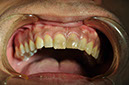 %_tempFileNameImplant%2061a1%